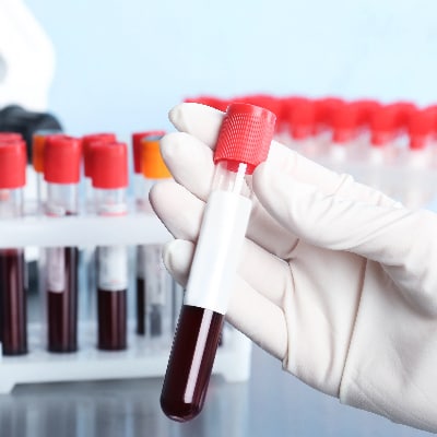 Medical Testing